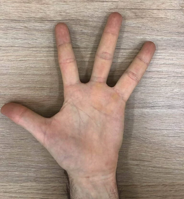Was fehlt hier in diesem Bild? hand